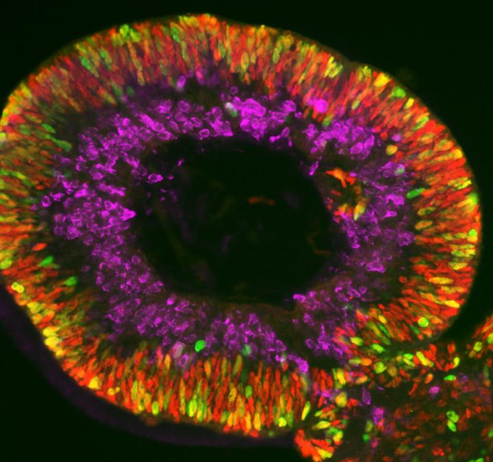 Retina Organoid