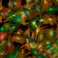 Human Stem-Cell-Derived Astrocytes