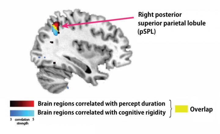 pSPL Correlates with Percept Stability and Cognitive Rigidity