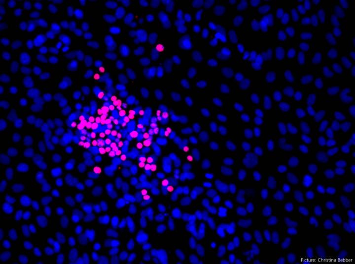 Inducing iron-dependent cell death in tumour cells