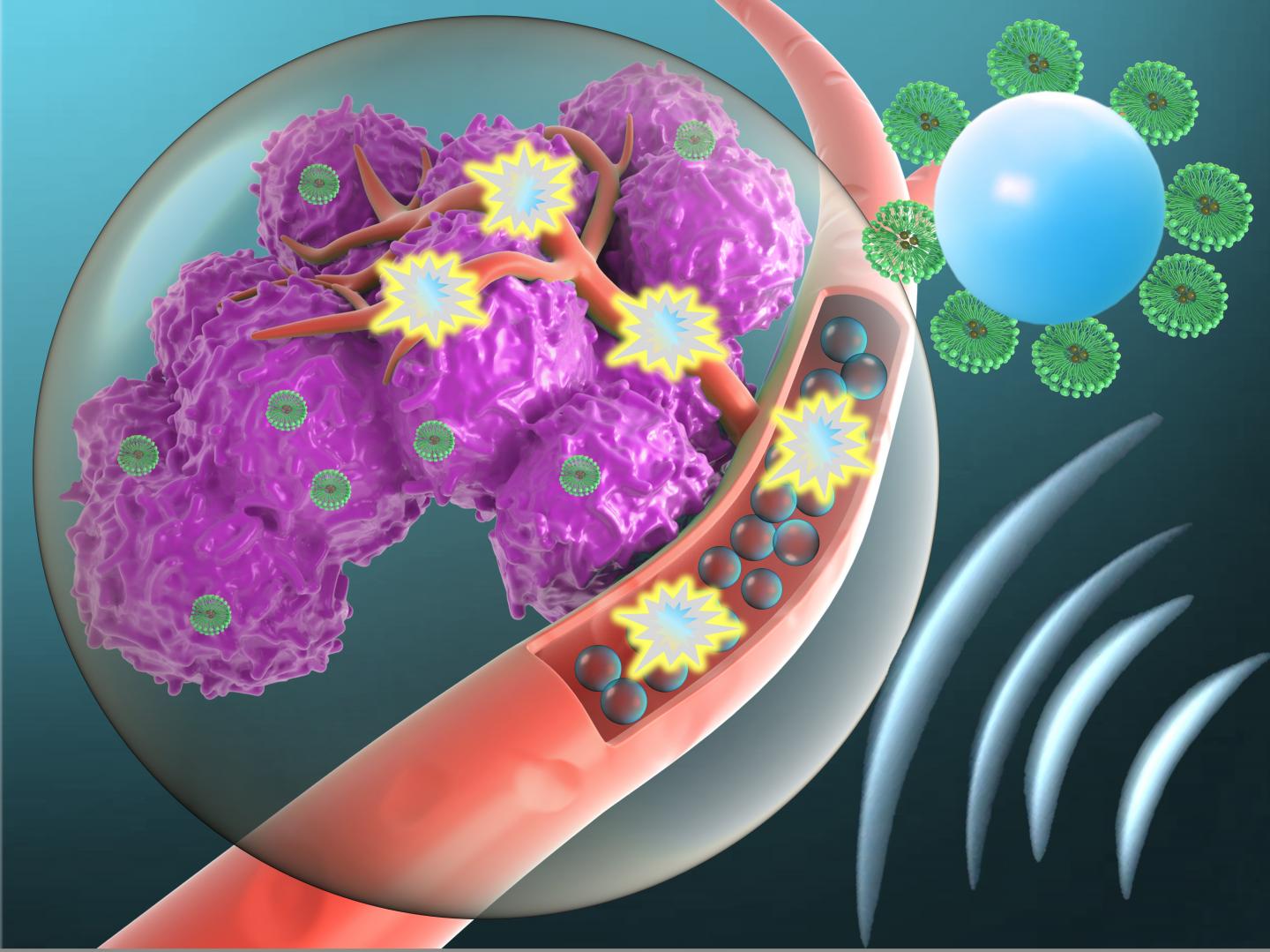 Microbubble and targeted anti cancer agent delivery