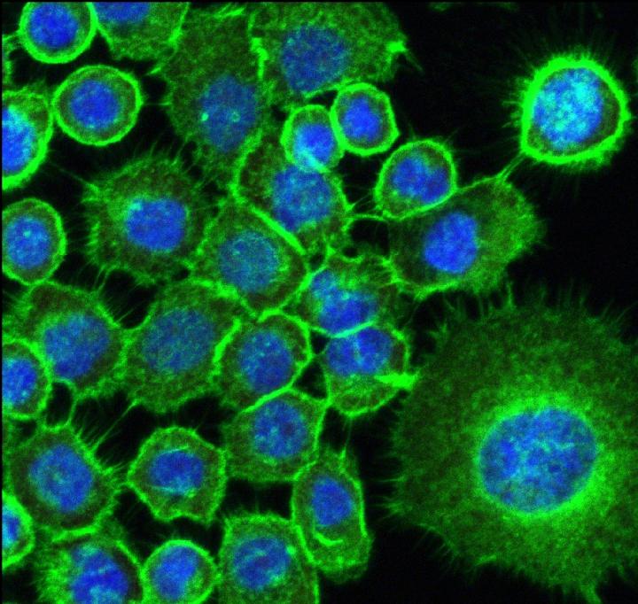 Microbial biofilms and cell behavior in head and neck cancer