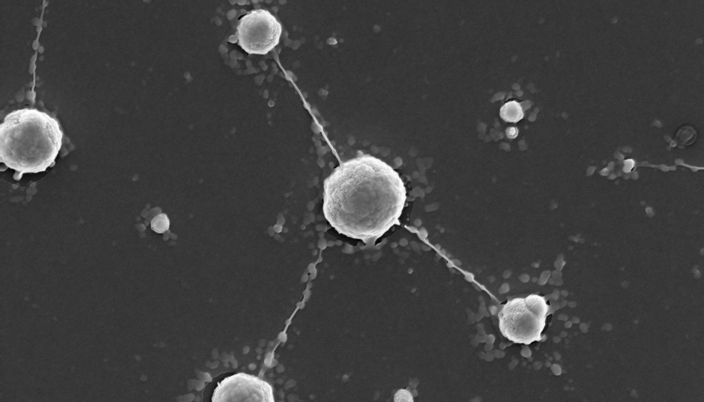 Tungsten Polyoxometalates I