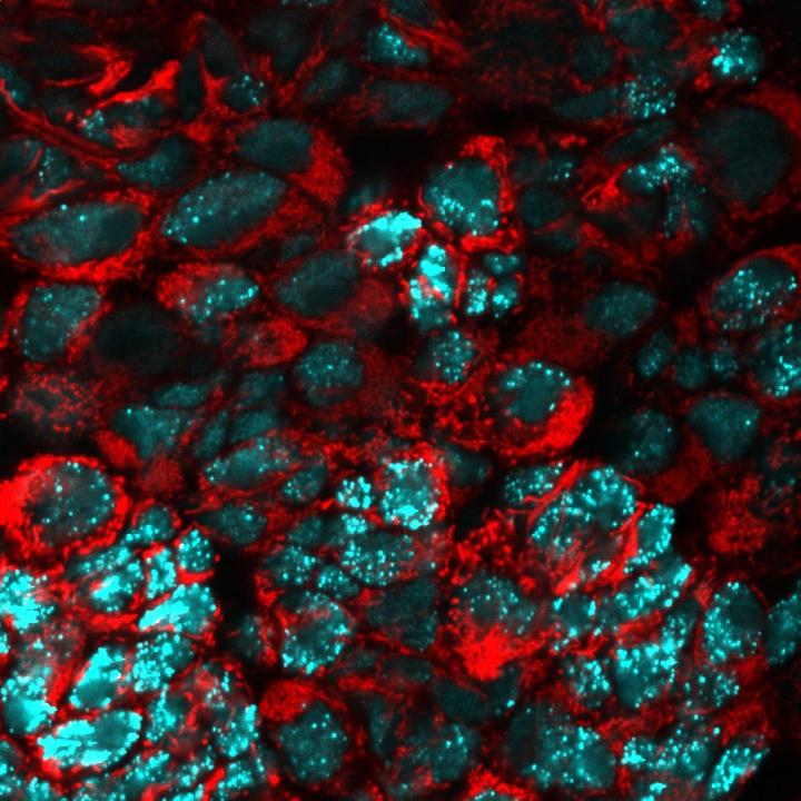 Mitochondrial Fusion of Tumor Cells