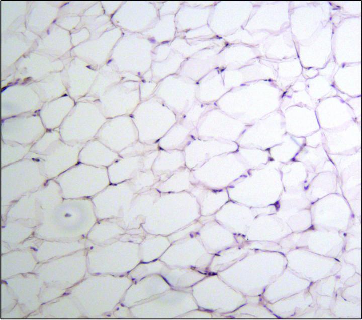 Microscopic Image of Healthy Fat Tissue