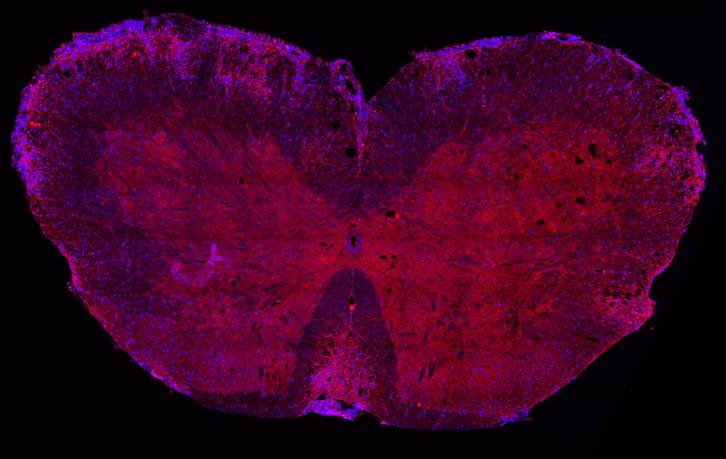 PKM2 enhances STAT3 activation in Th17 cells