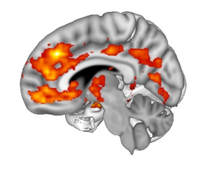 Cerebral cortex