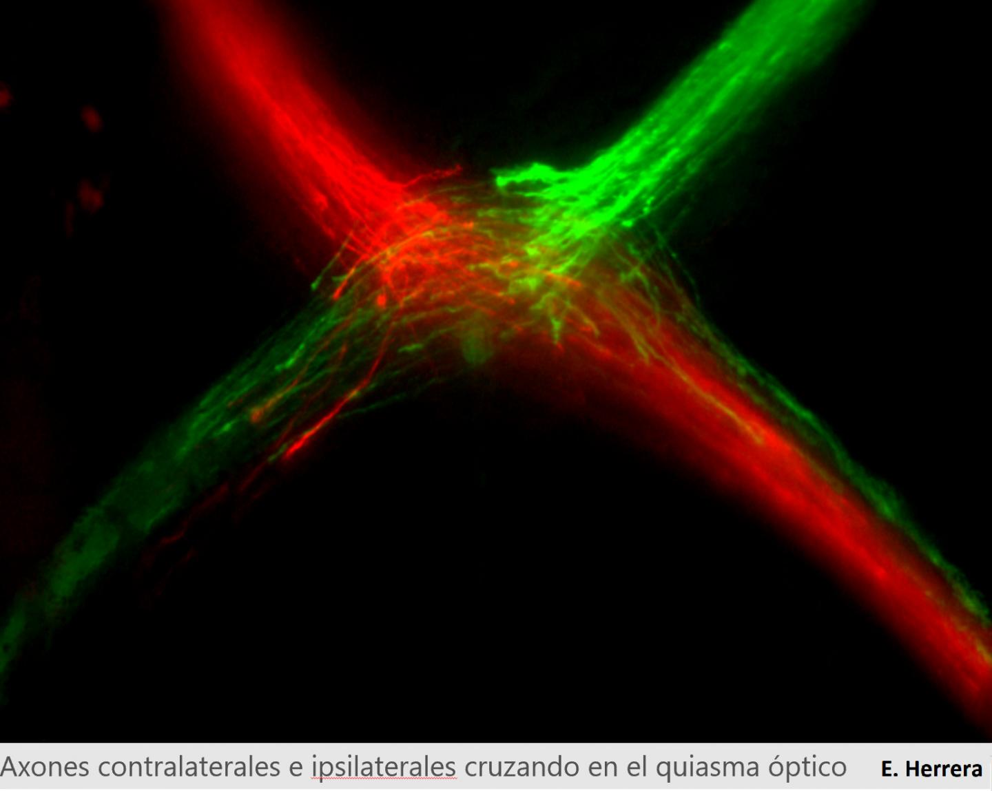 The two optic nerves converge in an X-shaped structure, called the optic chiasm, located at the base of the brain.