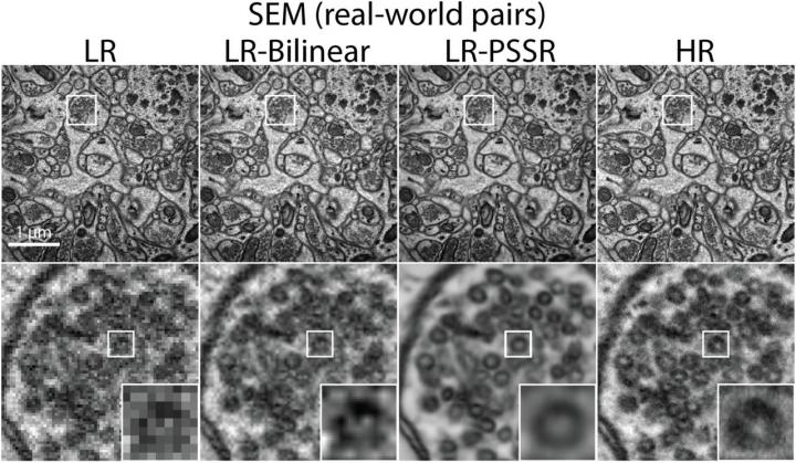 An Image Showing the Side by Side Versions of Electron Microscope Captures