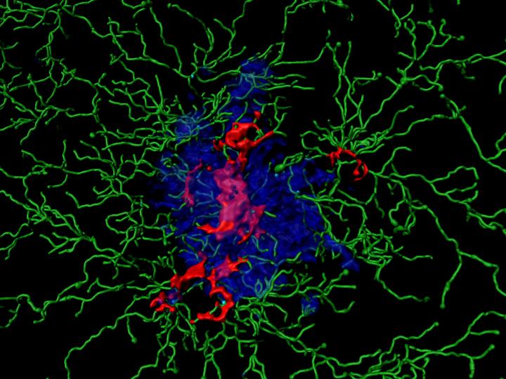 Inflammatory Proteins