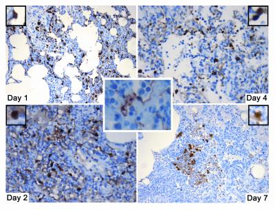 Lung Tissue Targeted