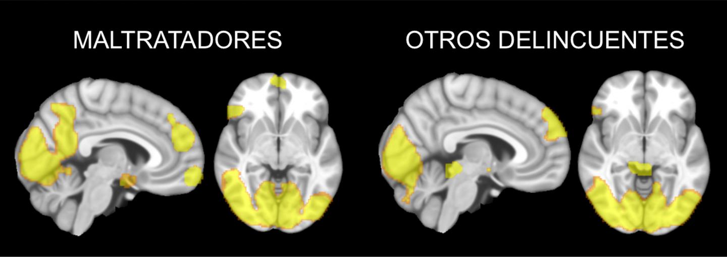 The Brain of Male Batterers Functions Differently Than That of Other Delinquents