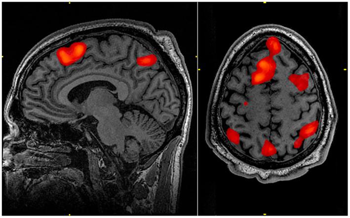 fMRI