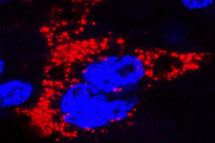Mouse Models of Zika in Pregnancy Show How Fetuses Become Infected
