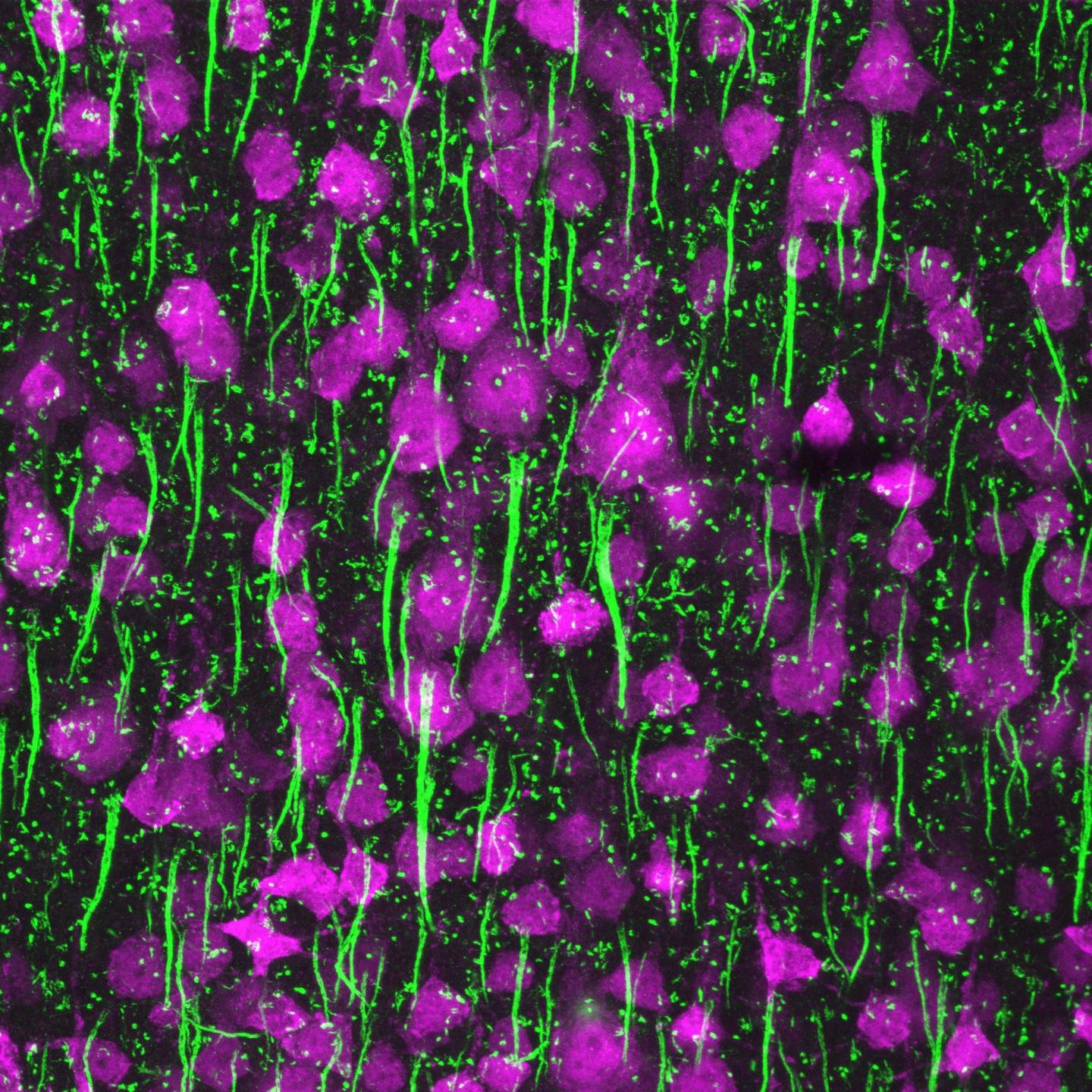A Garden of Axon Initial Segments