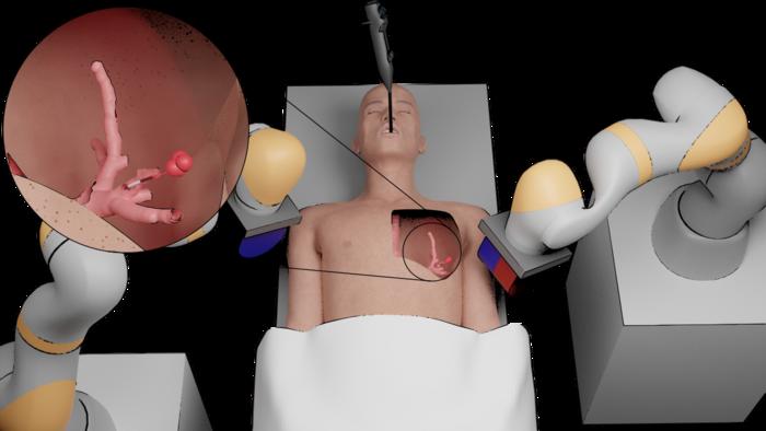 Magnetic personalized tentacles for targeted photothermal cancer therapy in peripheral lungs