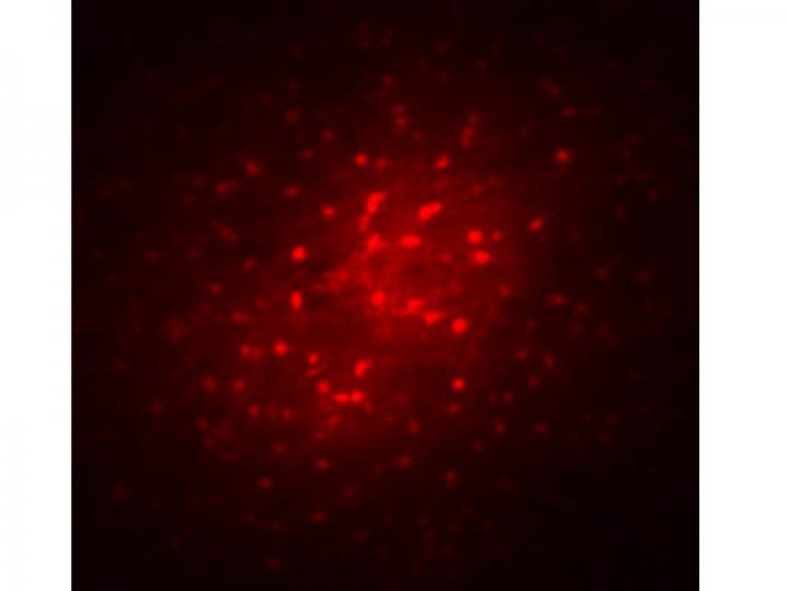 Astrocyte with Marker