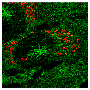 Microscopy image of human cells with microtubules (in green) growing from the centrosome and from the Golgi (labeled in red).