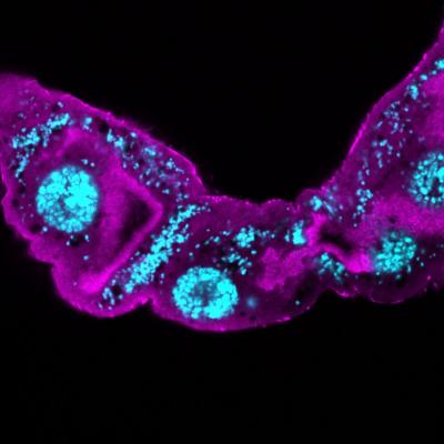 Fruit Flies Infected with Wolbachia