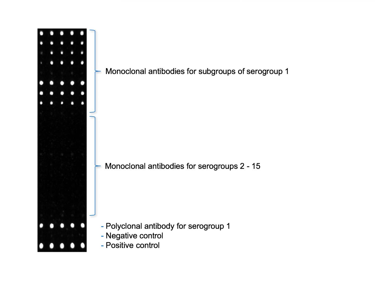 Sensor Image of <i>Legionella pneumophila</i>