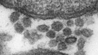 The virus-like particles found in bacteria inside Bugula neritina