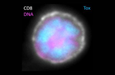 Exhausted CD8 T Cell 