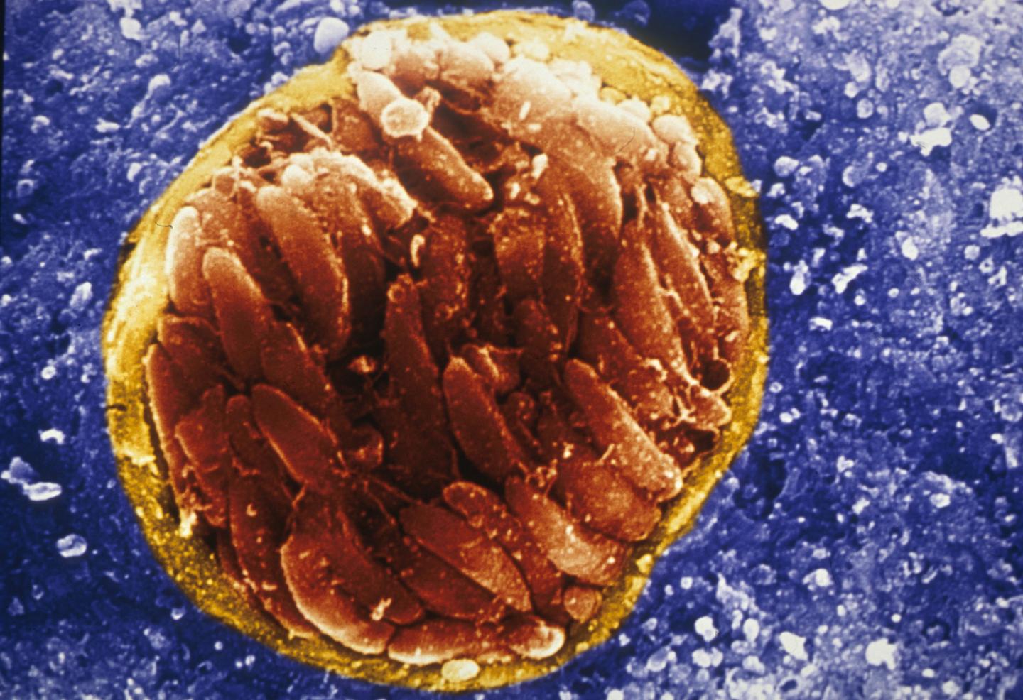 Toxoplasma gondii Tissue Cyst
