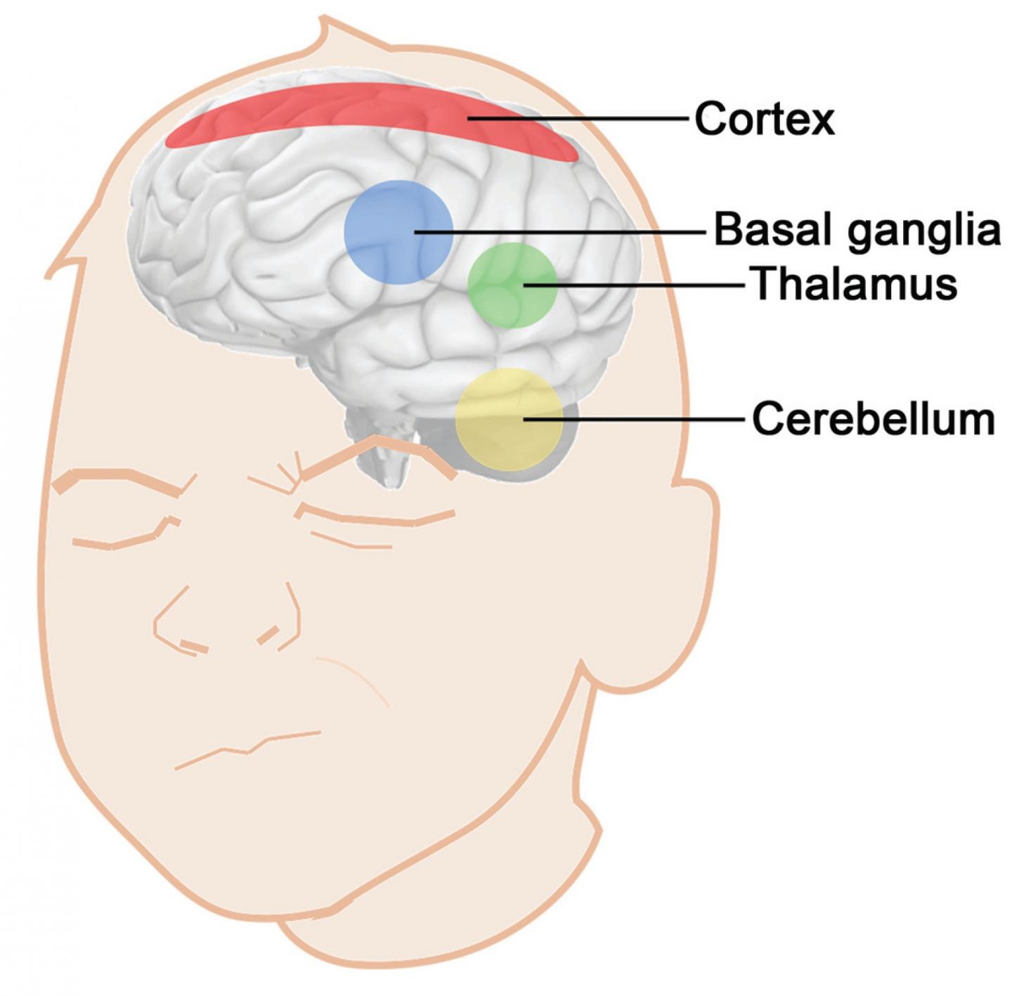 Brain's Role in Tourette Tics Simulated in New Computational Model