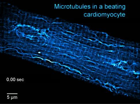 Microtubule Contractility (2 of 2)