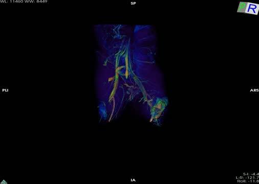 Scaling up a Nanoimmunotherapy for Atherosclerosis Through Preclinical Testing (2 of 8)