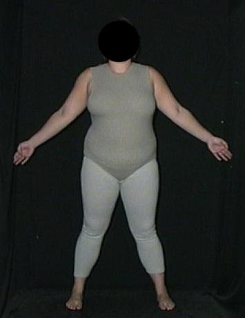 Test Image from Study