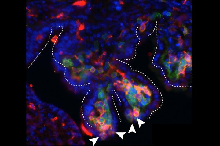Immune cells breaching the choroid plexus barrier
