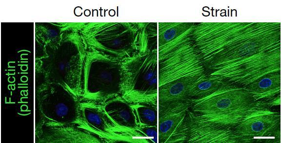 Stem Cells Respond to Mechanical Forces by Changing Their Structure