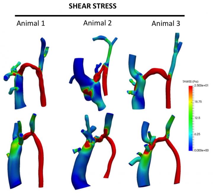A Reverse Approach to Vessel Surgery May Boost Clinical Outcomes in Dialysis (2 of 4)