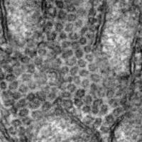 Electron Micrograph Image of the Vesicles