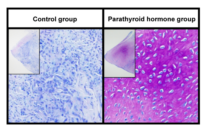 Regenerated meniscus stained with toluidine blue, using an Achilles tendon graft