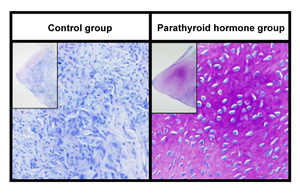 Regenerated meniscus stained with toluidine blue, using an Achilles tendon graft