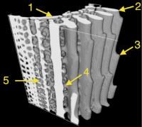 MicroCT Reconstruction of Spine
