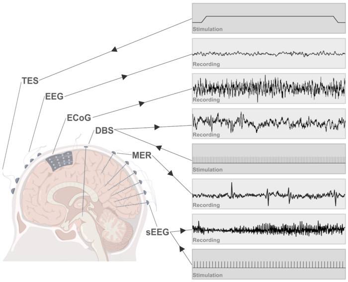 Figure 2. Major electrical rec [IMAGE] EurekAlert! Science News Releases