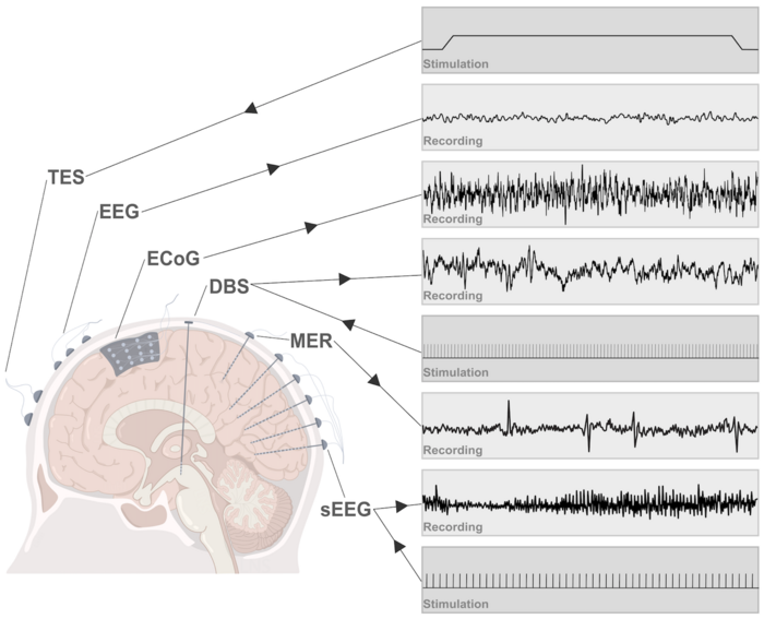 Figure 2. Major electrical recording and stimulation approaches for brain machine interfaces.