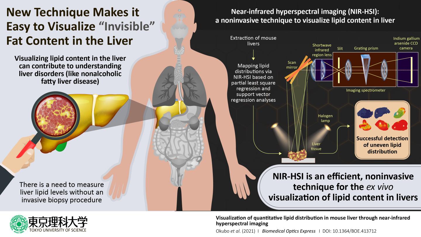 Quantitative Detection of Fatty Liver Disease
