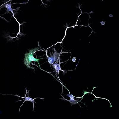 Neuron Network