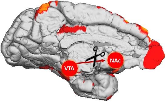 Primate Brain