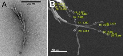 Electron Microscope Image of Alzheimer Fibrils