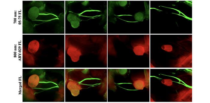 Two-color fluorescence nerve and tumor visualization, with green color for the 700-nm LGW05-75 imaging channel (top) and red color for the 800-nm ABY-029 imaging channel (middle row), and with the 700- and 800-nm fluorescence images merged (bottom).