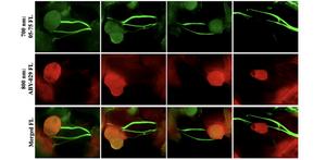 Two-color fluorescence nerve and tumor visualization, with green color for the 700-nm LGW05-75 imaging channel (top) and red color for the 800-nm ABY-029 imaging channel (middle row), and with the 700- and 800-nm fluorescence images merged (bottom).