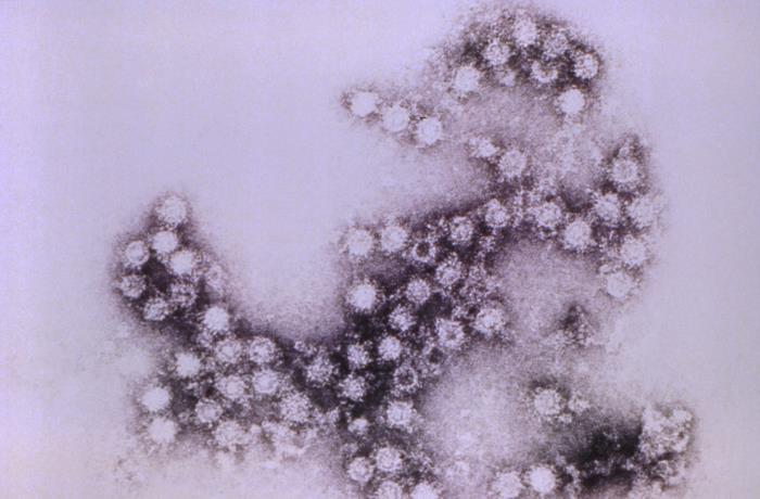 Enterovirus Coxsackievirus B4