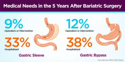 Gastric Sleeve Surgery - Baylor Medicine