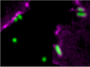 Cytoskeleton acts as cells’ bouncer for bacteria