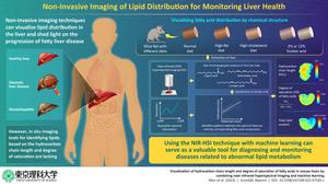 Label-free visualization of fatty acid distribution characteristics in the liver